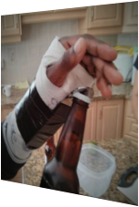 Mann öffnet mit Gipshand Bierflasche